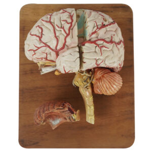 cerebro-viriathus-modelo