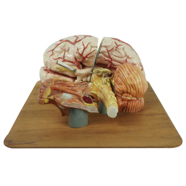 cerebro-viriathus-modelo